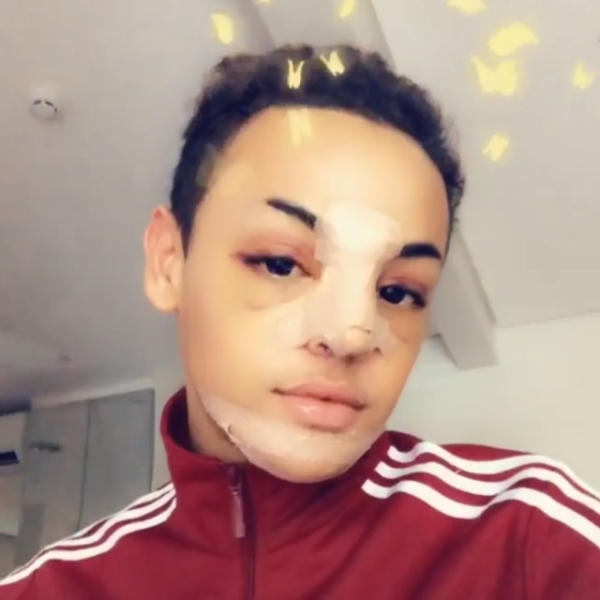 Pabllo Vittar, cirurgias